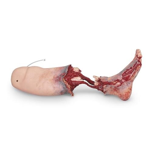 „Xtreme“ kraujuojanti traumuota koja „Xtreme“ kraujuojanti traumuota koja