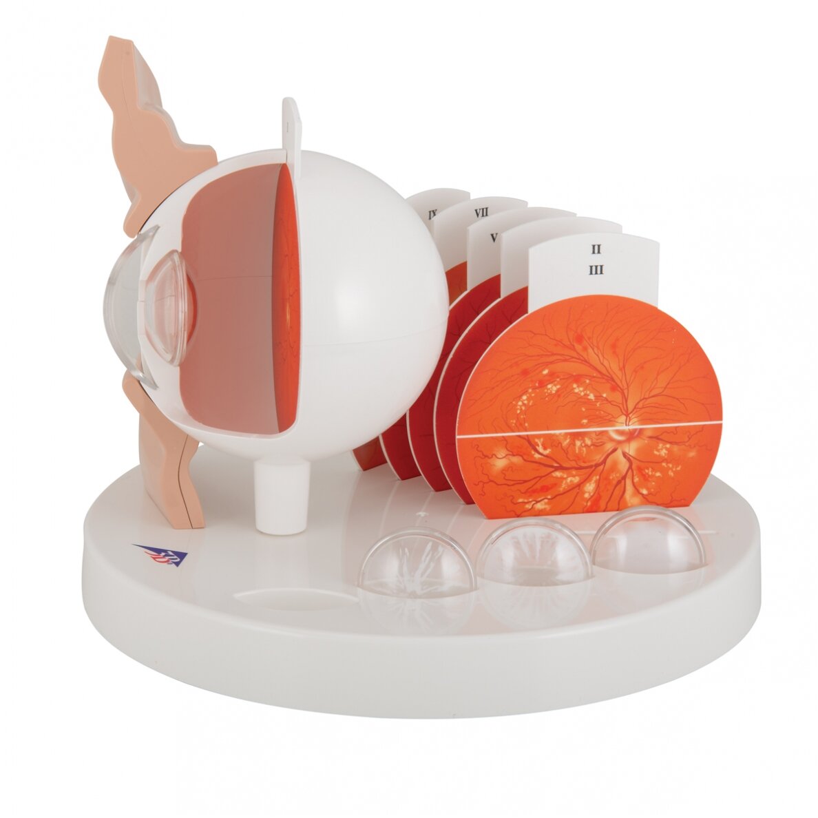 Žmogaus akių su patologijomis modelis 3 Žmogaus akių su patologijomis modelis 3