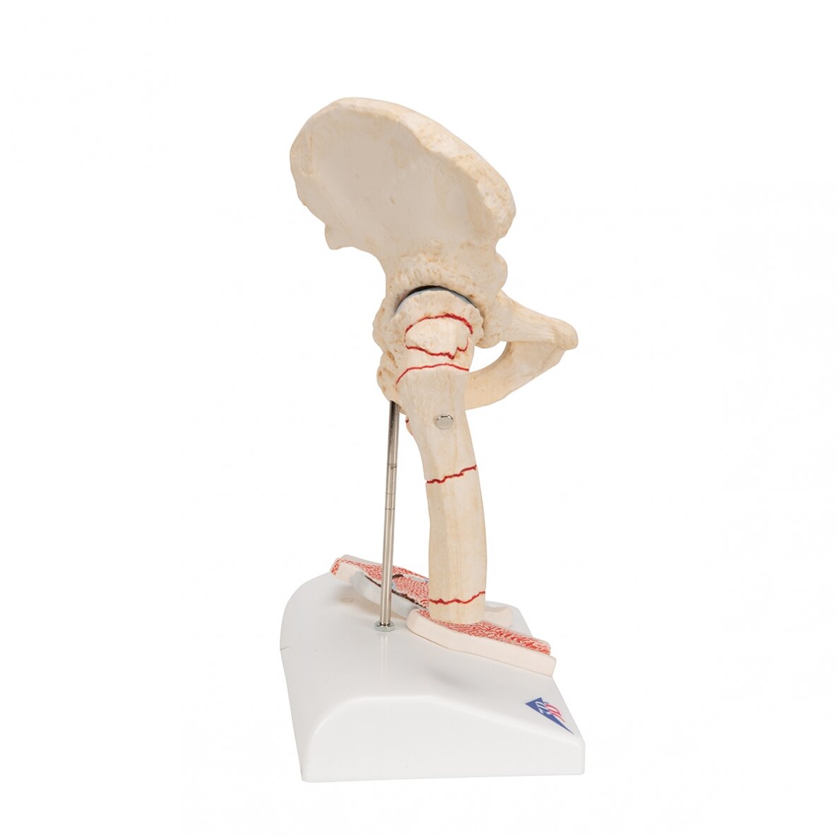 Žmogaus šlaunikaulio lūžio ir klubo osteoartrito modelis 3