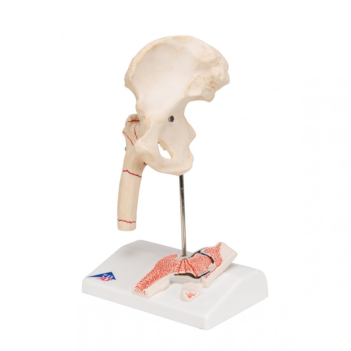 Žmogaus šlaunikaulio lūžio ir klubo osteoartrito modelis 4 Žmogaus šlaunikaulio lūžio ir klubo osteoartrito modelis 4