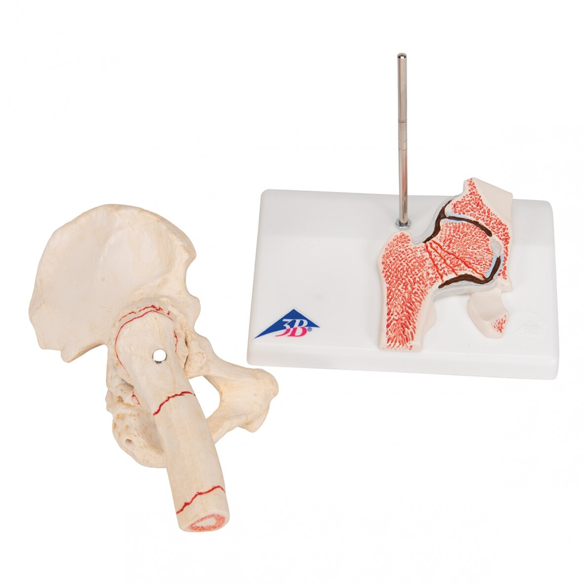 Žmogaus šlaunikaulio lūžio ir klubo osteoartrito modelis 5
